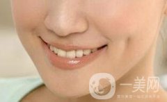 人造酒窩前后照片一覽？大概要多少錢？