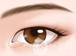 開眼角的*果怎么樣 好不好？