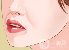 自體脂肪填充鼻唇溝怎么樣 能保持多久？