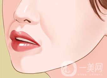 自體脂肪填充鼻唇溝怎么樣 能保持多久？