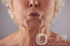出現(xiàn)煙民線該如何解決呢？
