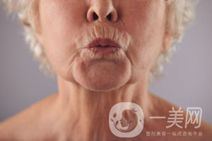 出現(xiàn)煙民線該如何調(diào)節(jié)呢？