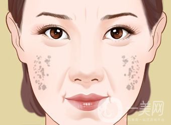 怎樣治老年斑 調(diào)節(jié)方法有哪些？