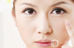 淚溝填充消腫需要多長(zhǎng)時(shí)間？