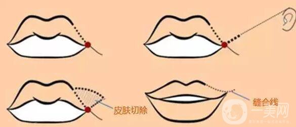 標(biāo)準(zhǔn)的仰月唇女明星有哪些？其中還有AB的整容模板！