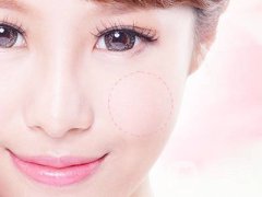 改變臉型手術(shù)要多少錢(qián)呢？
