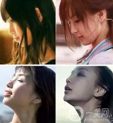 有沒有可能Angelababy不做整容手術(shù)就改變了這么多？