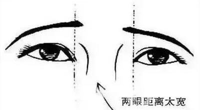 開眼角疼嗎？這幾種情況開眼角*果堪比換頭！