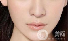 下巴打幾次能定型*？玻尿酸墊下巴多少錢？