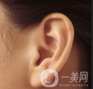 自體脂肪豐耳垂好嗎？*嗎？