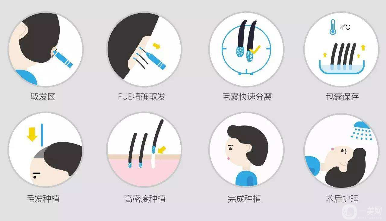 科普：植發(fā)3000單位要多少錢？脫發(fā)的原因