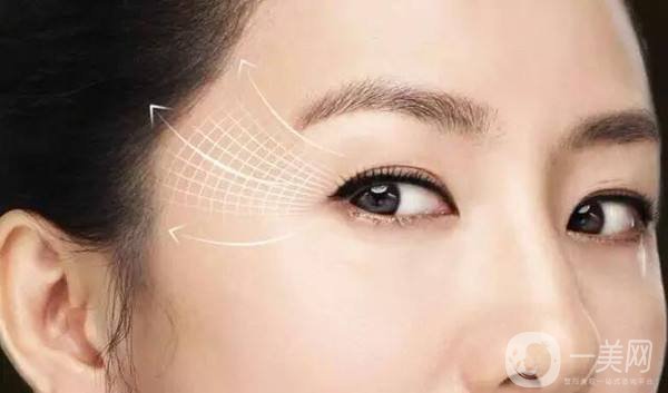 眼部除皺的價錢 怎么去眼周細(xì)紋