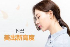 假體下巴風險有哪些？做完能管多久