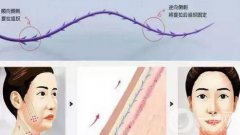 過了25歲該怎么辦？抗衰方式分享