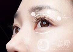 割雙眼皮有哪些風(fēng)險？有失敗的嗎？