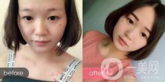 成都紋眉價(jià)格 成都現(xiàn)在文眉多少錢(qián)?