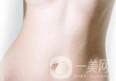 腹壁整形手術(shù)需要多少錢(qián)？