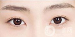 成都繡眉價(jià)格是多少?繡眉價(jià)格多方面分析