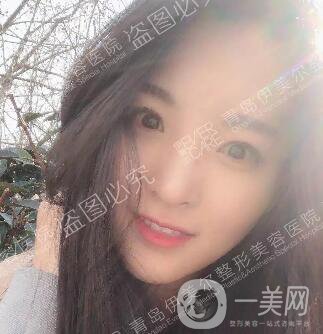 開眼角價格