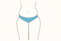 360度環(huán)形吸脂果如何 有哪些優(yōu)勢呢