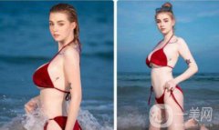 乳房縮小是為了什么呢 來(lái)聽(tīng)聽(tīng)專家的解說(shuō)