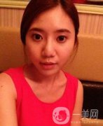 去頰脂墊果圖賞析 沒(méi)有就沒(méi)有傷害