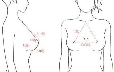 假體隆胸術有哪些特點？