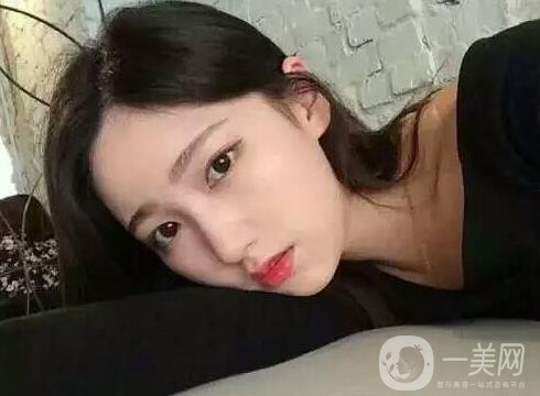 雙下巴吸脂后一個(gè)月還是有雙下巴，是失敗了嗎?