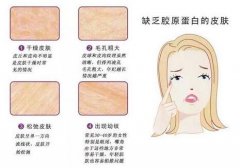 填充膠原蛋白發(fā)硬凸起應(yīng)該怎么辦？