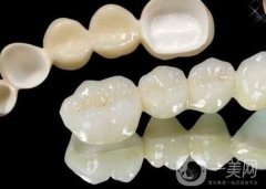 二氧化鋯全瓷牙修復(fù)果怎么樣？