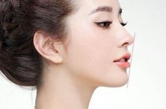 玻尿酸豐下巴的優(yōu)勢有哪些?可以保持多久?