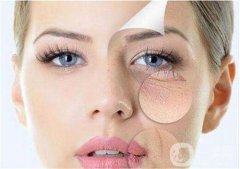 激光去眼袋的價格多少？要打幾次？
