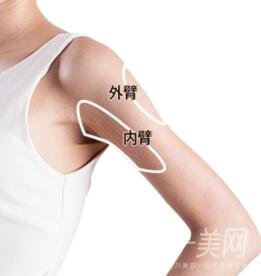 上臂吸脂多久恢復(fù)？需要住院嗎？