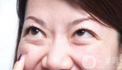 去眼袋手術(shù)價格是多少？與哪些因素有關(guān)？