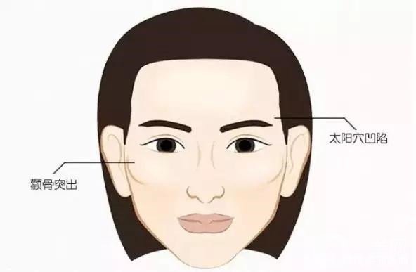 顴骨內(nèi)推和磨骨之間的區(qū)別是什么？哪個*果好些？