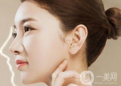 隆鼻后怎么消腫比較快呢？幾個(gè)妙招分享