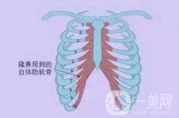 肋軟骨隆鼻為什么老受推薦？到底好在哪里？