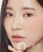 開眼角前后照片圖，放大眼睛不是一點(diǎn)點(diǎn)