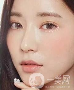 開眼角前后照片圖，放大眼睛不是一點(diǎn)點(diǎn)