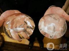 曼托假體和麥格假體哪種手感更好？教你怎么選擇？