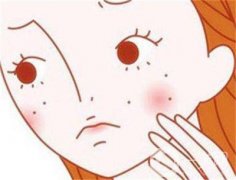 激光祛斑祛痘好不好？要調(diào)節(jié)多少次？