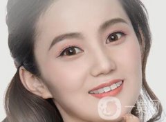 歪鼻矯正注意事項說明?包括術(shù)前術(shù)后哦