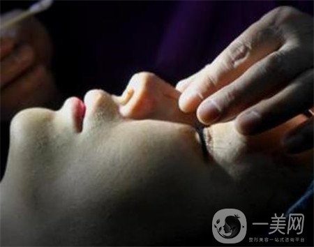 硅膠隆鼻能保持多久？可以終身保持嗎？