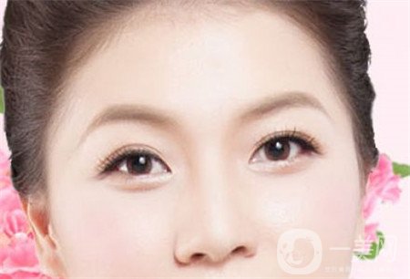 韓式開眼角多少錢？普遍價位是多少？