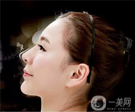膨體隆鼻后期*果自然嗎?山根會(huì)不會(huì)變矮一些?