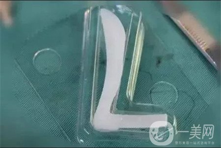 膨體隆鼻缺點是什么？優(yōu)點有哪些？