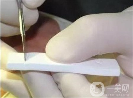 膨體隆鼻術(shù)后注意事項有哪些？需要忌口嗎？