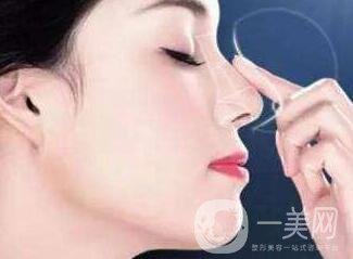 鼻子整形價(jià)格多少錢？影響價(jià)格因素有哪些？