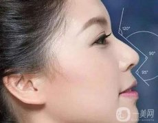 在上海做鼻子手術(shù)要多少錢?