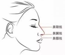 硅膠隆鼻一定會(huì)下滑嗎?下滑了怎么辦?